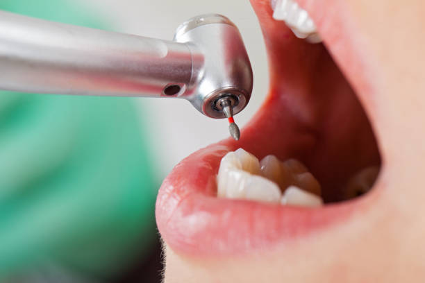 Best Urgent Tooth Repair  in Hudson Falls, NY